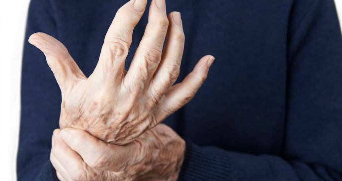 Nuevas pistas sobre el daño tisular identificado en la artritis reumatoide y el lupus