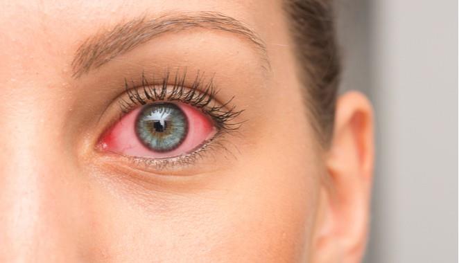 Así es como la artritis afecta la vista