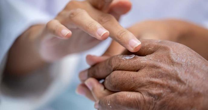 Tratamiento tópico en gel podría combatir el cáncer de piel, según investigadores