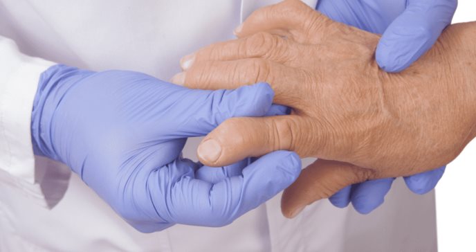 Pacientes puertorriqueños con artritis reumatoide detienen su tratamiento a los dos años, según estudio