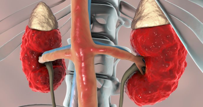 Estudio comprueba que la anemia aumenta a medida que la enfermedad renal crónica empeora