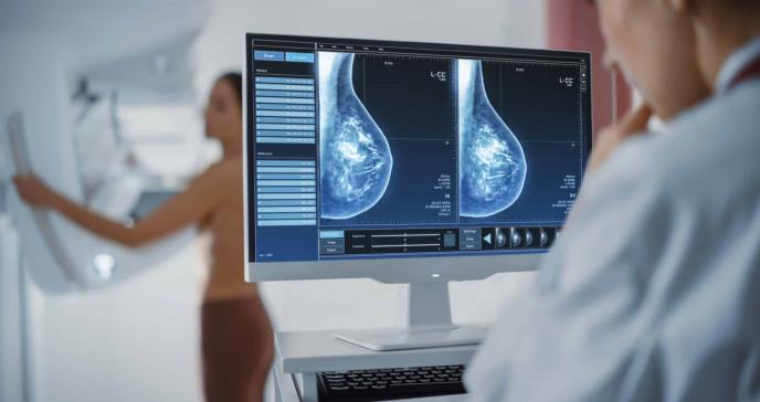 ¿Qué beneficios tiene la mamografía?