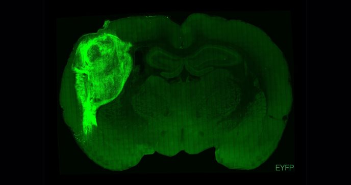Injertos de neuronas humanas en el cerebro de roedores logran influir en su comportamiento