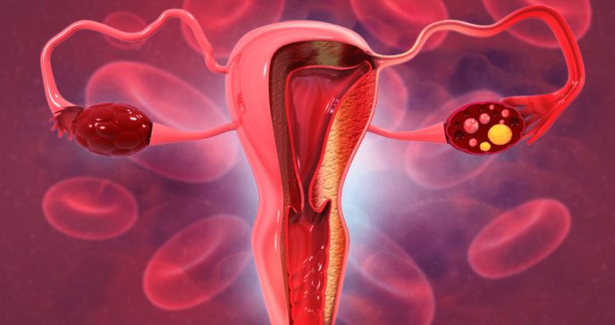 Síndrome de Rokitansky: la condición que provoca que las mujeres nazcan sin útero ni canal vaginal