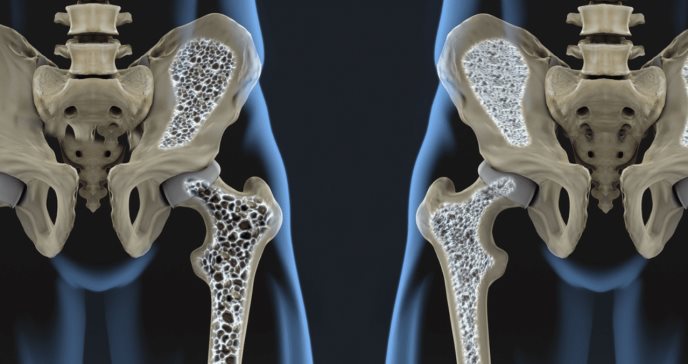 UCSF y la NASA adelantan investigación sobre osteoporosis y la absorciometría de rayos X de energía dual