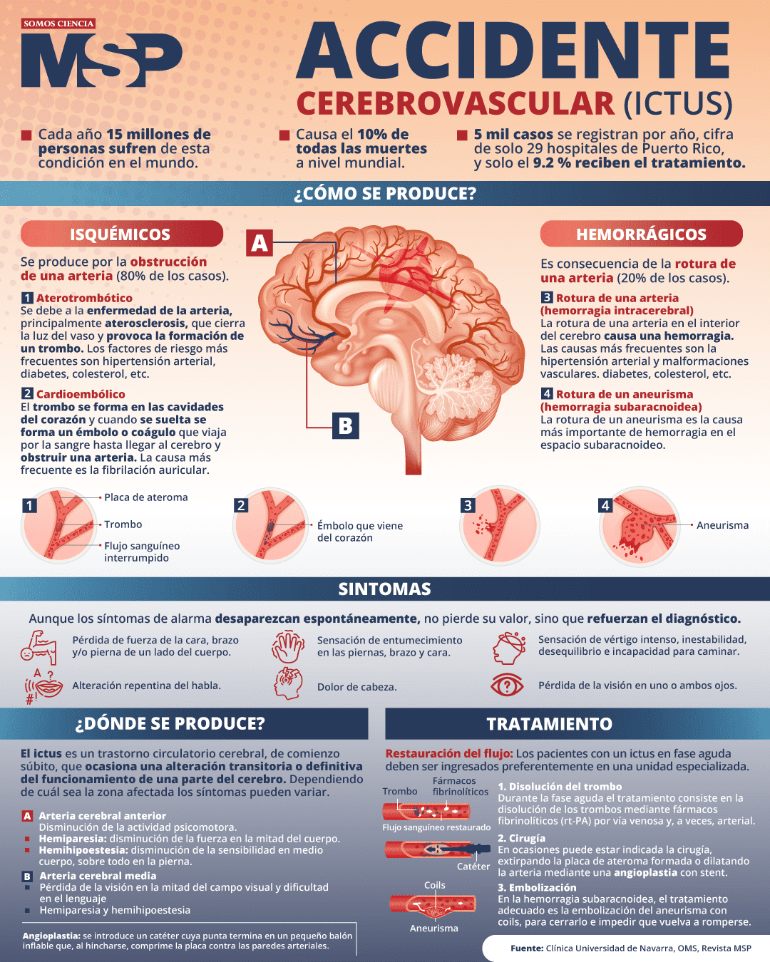 Accidente Cerebrovascular Infograf a