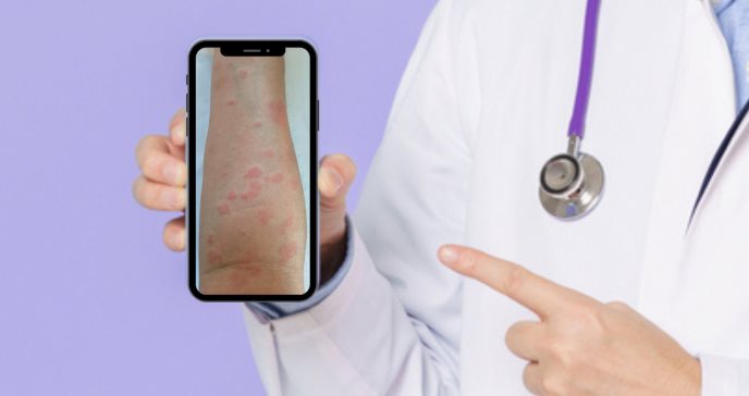 ´Espacio Interferón´: la nueva app informativa sobre el Lupus Eritematoso Sistémico para profesionales