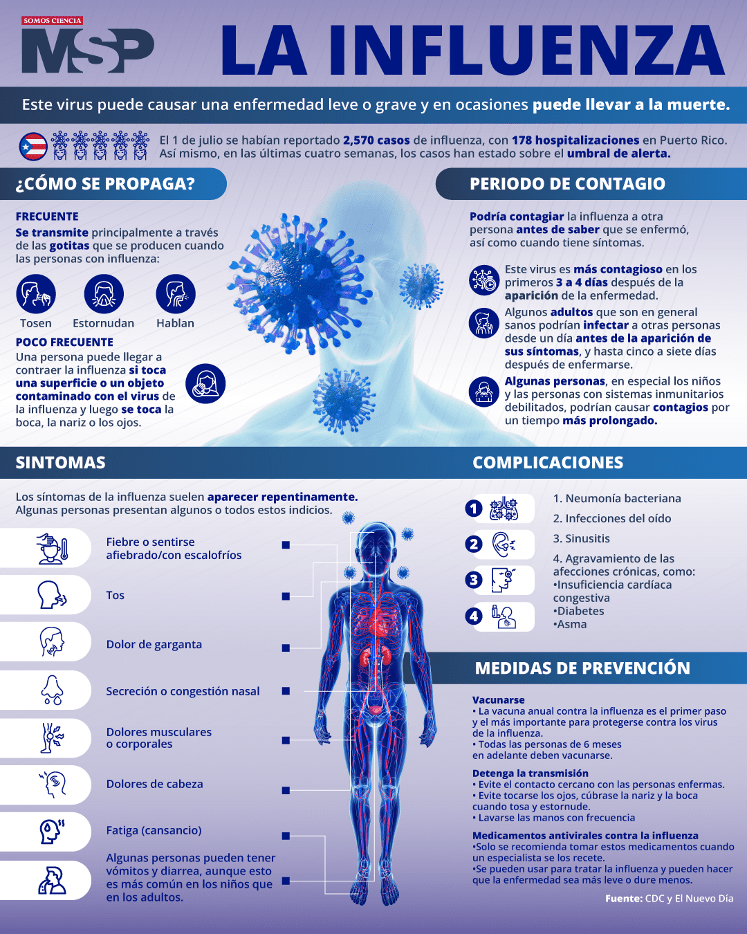 La Influenza Infografía