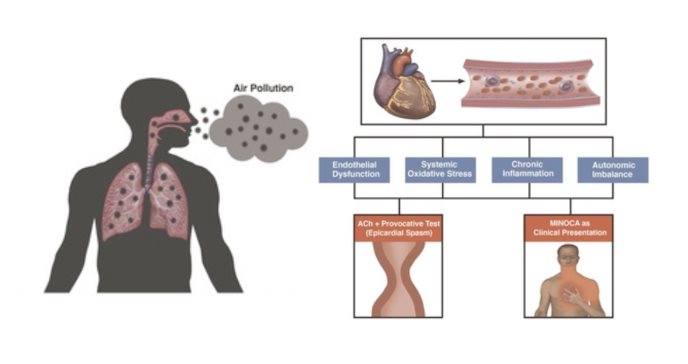 Contaminación del aire se asocia a trastornos vasomotores coronarios en pacientes con isquemia miocárdica