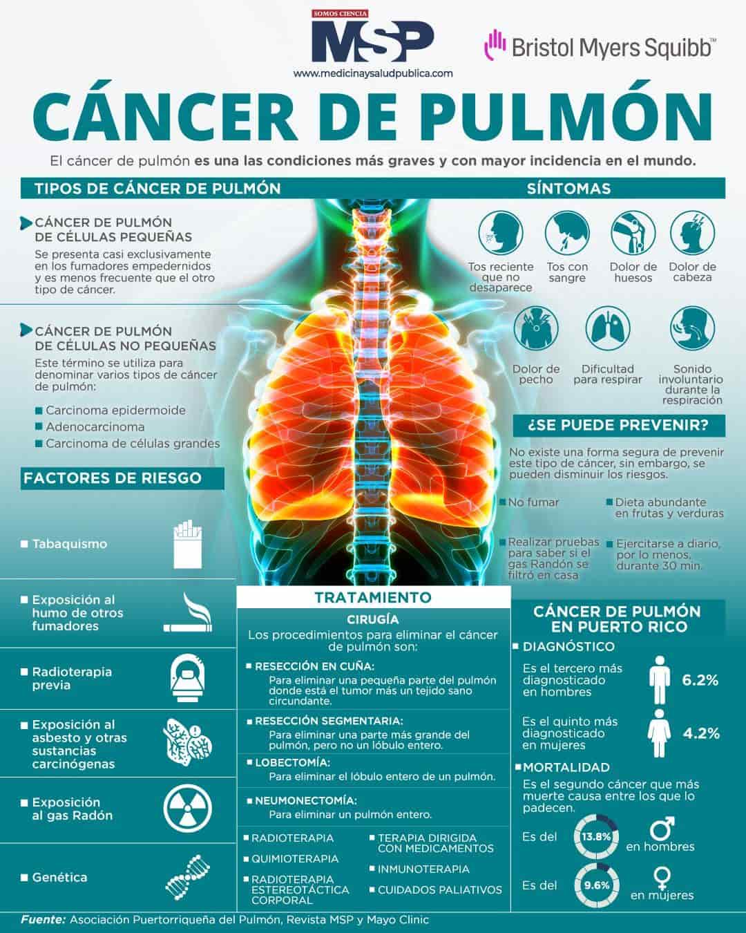 Cáncer Del Pulmón Infografía