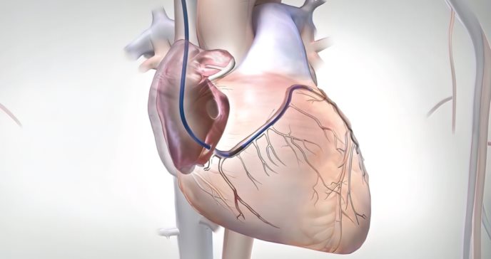 Rivaroxabán para la fibrilación auricular en la cardiopatía reumática