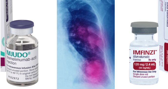 FDA aprueba combinación de medicamentos y quimioterapia para tratamiento del cáncer de pulmón metastásico