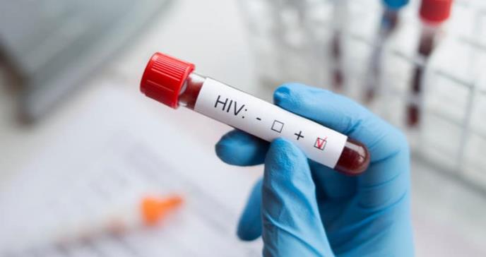 Incidencia del cáncer anal aumenta en población con VIH, según estudio epidemiológico