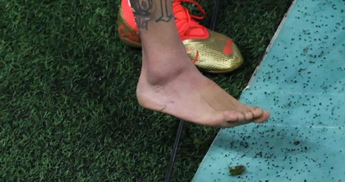 Mundial de Qatar: lesiones en futbolistas son musculares en el 60 % de los casos