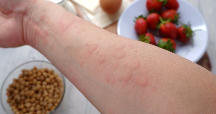 Tira reactiva podría detectar alérgenos en alimentos en tan solo cinco minutos