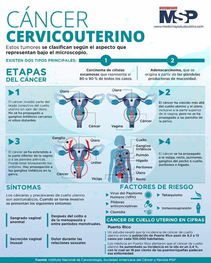 Cáncer Cervicouterino Infografía