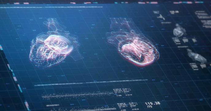 Nuevo algoritmo permite predecir el riesgo de muerte súbita cardiaca en población sana