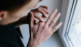 Artritis infecciosa aguda