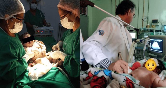 Macrosomía fetal: el sorprendente caso de un bebé gigante que nació en Brasil pesando 7,3 kg