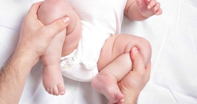 ¿Cómo reconocer la displasia de caderas en bebés?