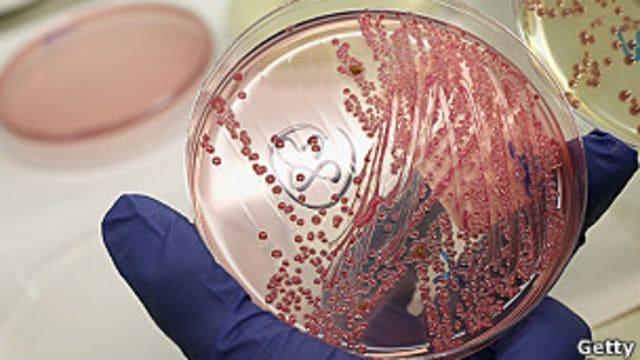 Potencial de infección por Escherichia coli en granja puertorriqueña de vacunos