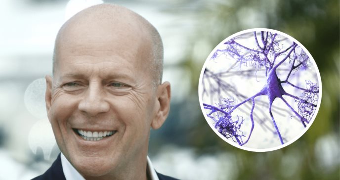 Demencia Frontotemporal: el trastorno neuronal que afecta al actor Bruce Willis