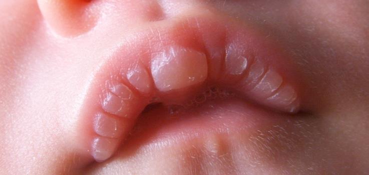 Ampollas en los labios de mi bebé, ¿Qué significa?