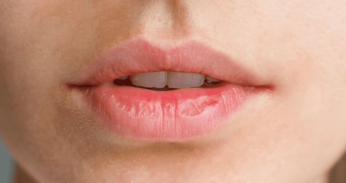 ¿Labios agrietados y con descamación? Conozca las causas de la queilitis