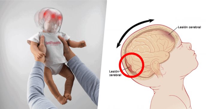 Síndrome del bebé sacudido: la mortal consecuencia de agitar bruscamente sus cabezas