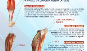 Qué partes de la zona inferior de la pierna duele y a qué se debe - Infografía