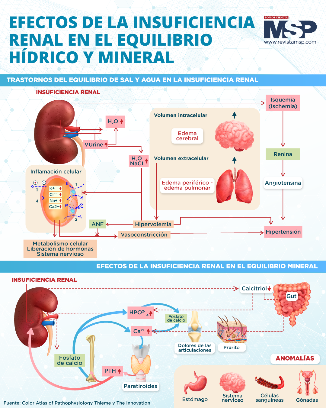 Efectos De La Insuficiencia Renal En El Equilibrio Hídrico Y Mineral Infografía 6359