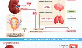 Efectos de la insuficiencia renal en el equilibrio hídrico y mineral - Infografía