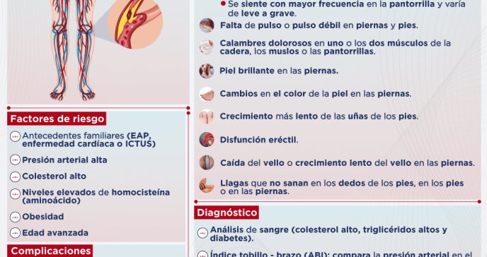 Enfermedad Arterial Periférica - Infografía