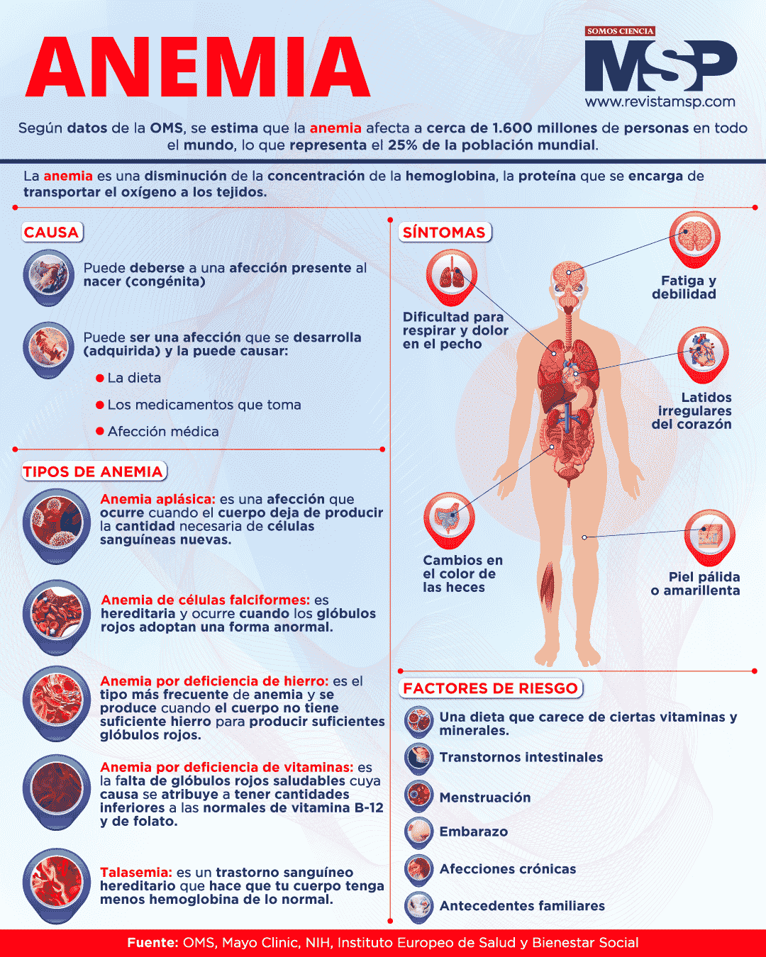 Anemia - Infografía