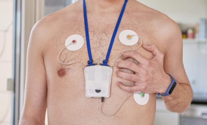 Electrocardiografía ambulatoria: examen para analizar el ritmo cardíaco