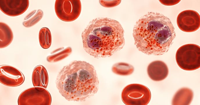 Niveles bajos y altos de glóbulos blancos eosinófilos: signo de cáncer, infección y reacciones a fármacos