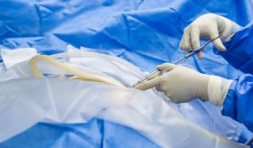 ¿La cirugía es la mejor solución para tratar la ciática?