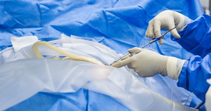¿La cirugía es la mejor solución para tratar la ciática?