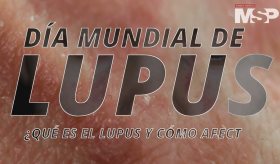 Día Mundial del Lupus: ¿Qué es el lupus y cómo afecta? - #EspecialMSP