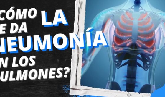 ¿Cómo se da la neumonía en los pulmones? - #ExclusivoMSP
