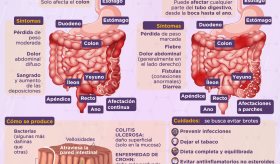 Enfermedad inflamatoria del intestino - Infografía