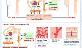 Causas y efectos de la deshidratación e hiperhidratación - Infografía