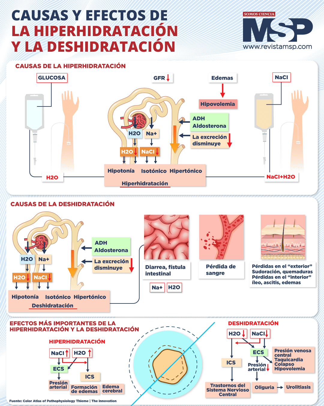 Causas y efectos de la deshidratación e hiperhidratación - Infografía