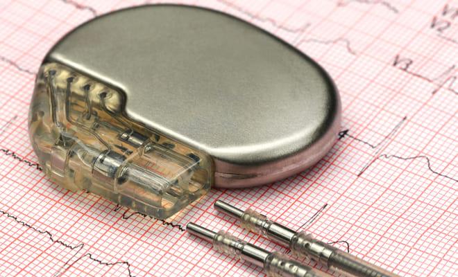 Patentan marcapasos que funciona con la energía de los latidos cardíacos