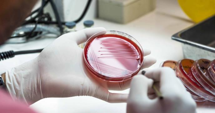 Inteligencia artificial descubre nuevo antibiótico capaz de eliminar peligrosa superbacteria A. baumannii