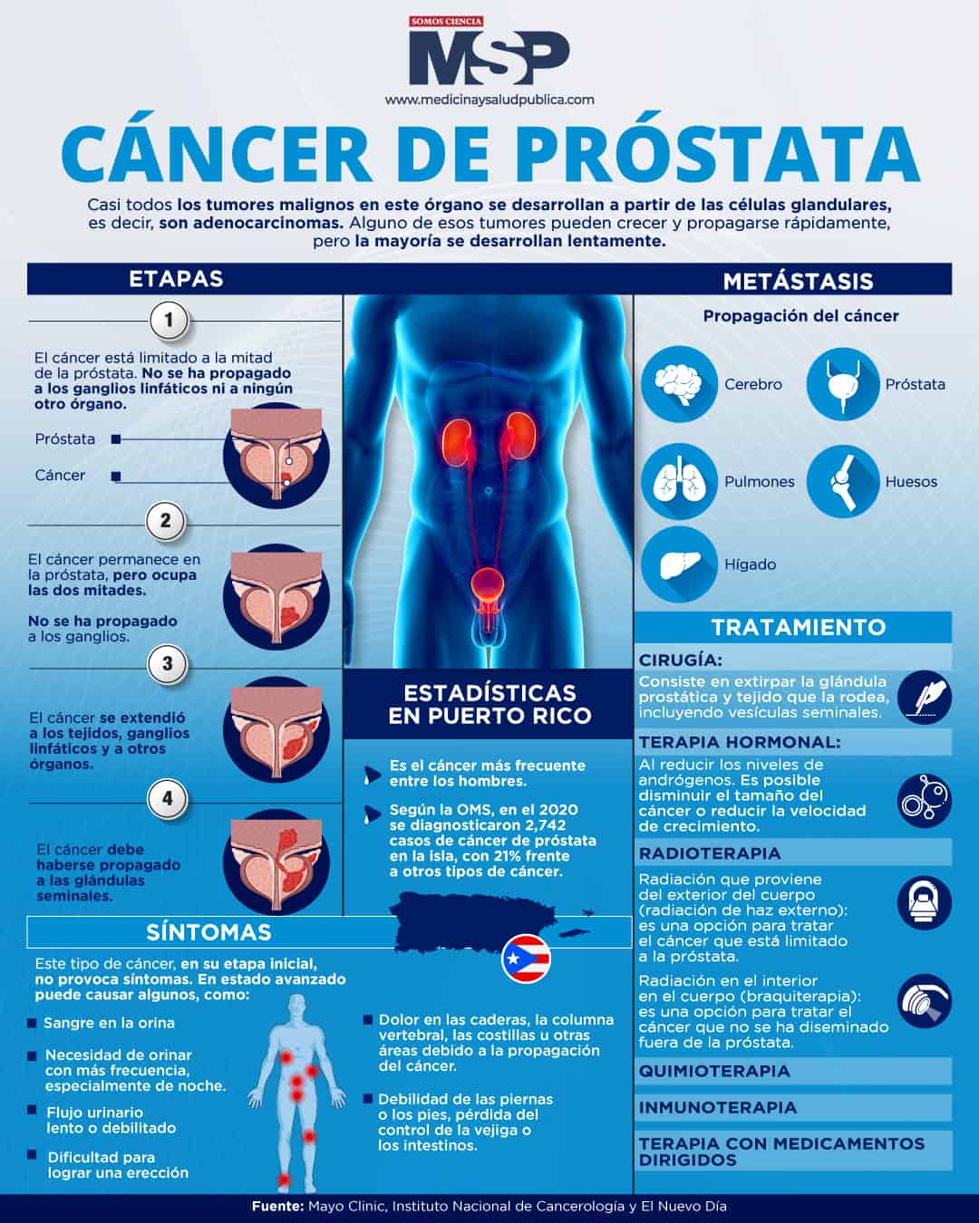 estadísticas de cáncer de próstata 2023