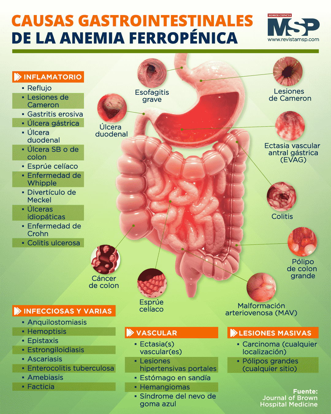 Causas Gastrointestinales De La Anemia Ferropénica 2138