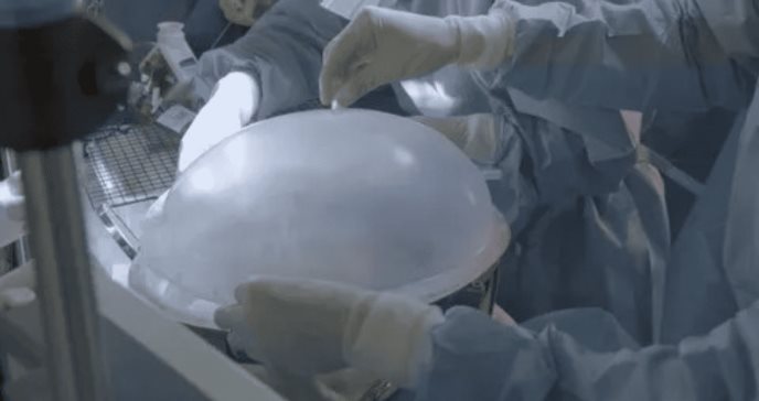 Desarrollan prototipo de placenta artificial para mejorar la supervivencia de prematuros extremos
