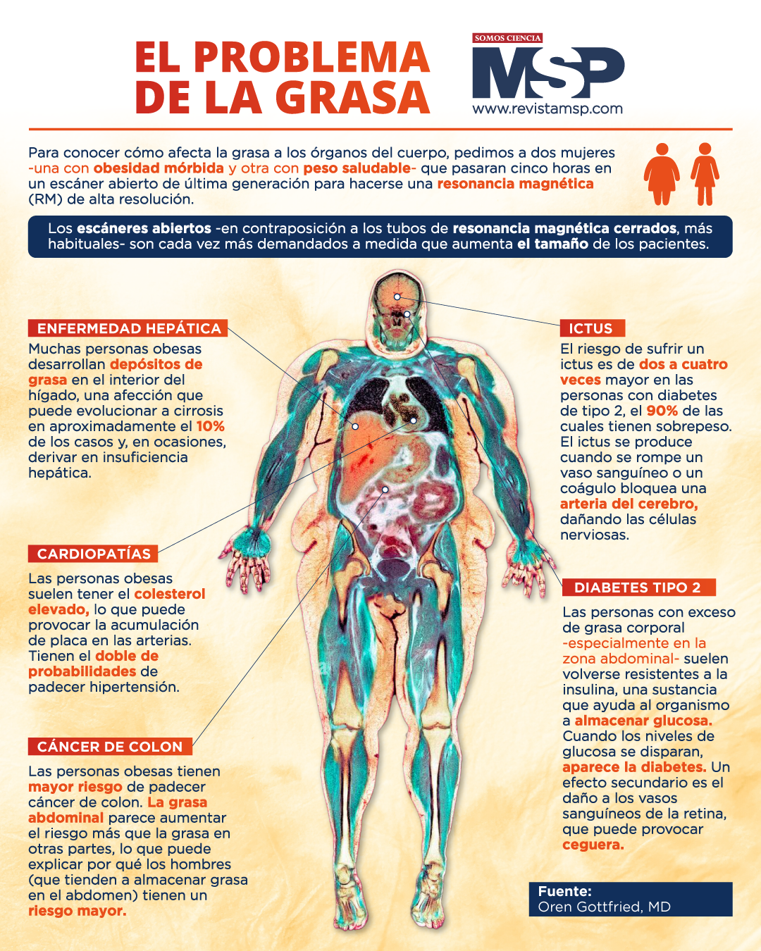 El Problema De La Grasa 4645