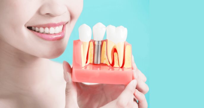 Medicamento en investigación podría ofrecer una alternativa a los implantes dentales